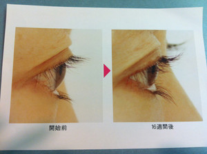 Photo_4