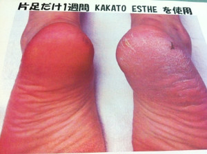 Photo_2