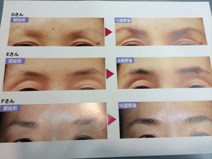 Photo_3