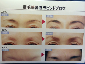 Photo_4