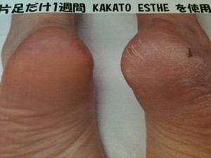 Photo_5