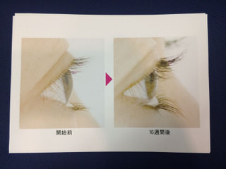 まつ毛が伸びる！？