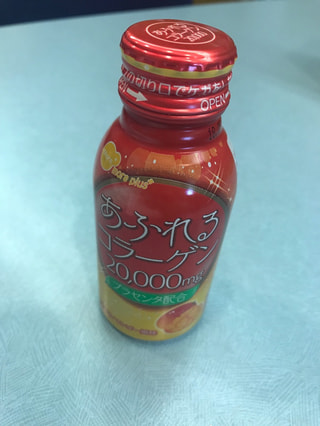 コラーゲン注入。