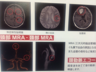 脳の検査に行こう！